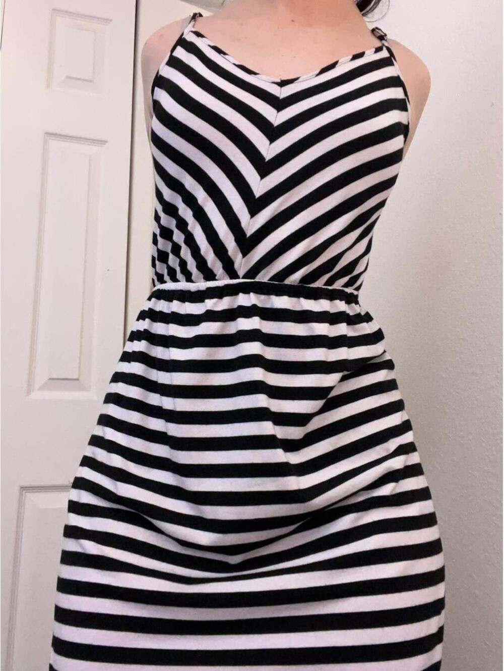 striped babydoll dress